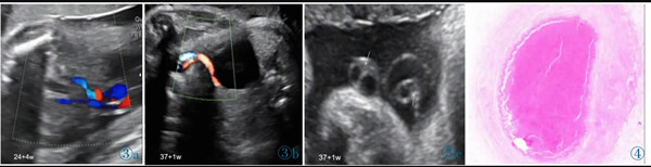 臨床醫(yī)學(xué)論文5000字 臨床醫(yī)學(xué)論文5000字